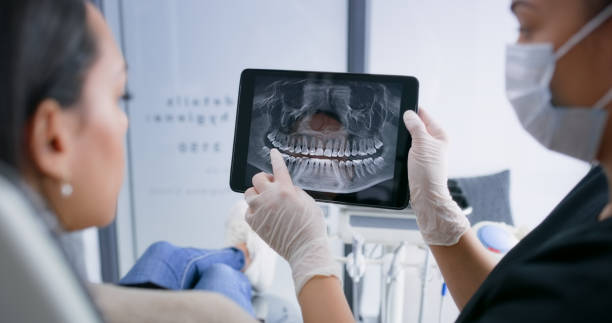 Licensed Tooth Extraction service in Fannett, TX - Smile Center Dentistry